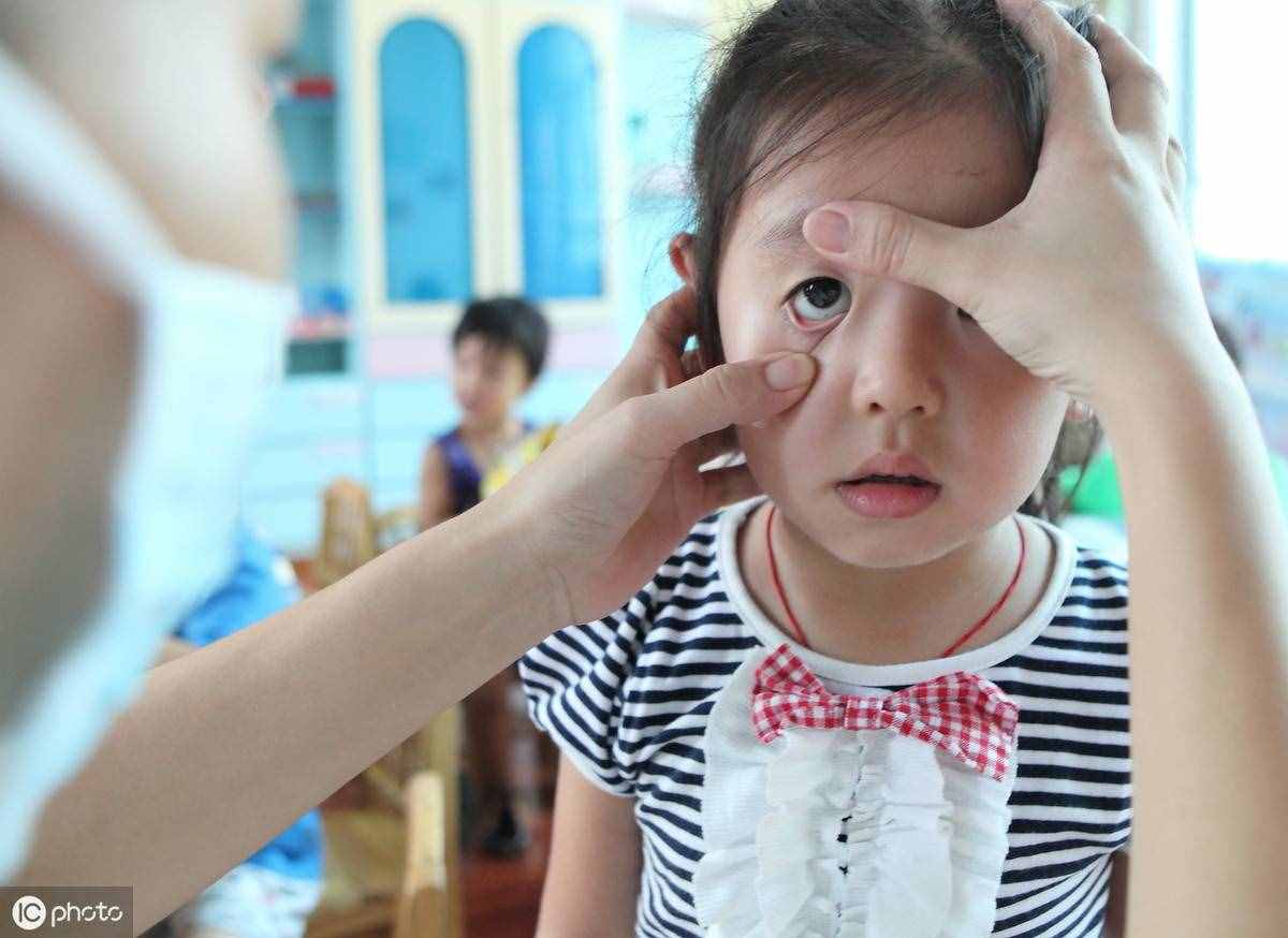 紅眼病的癥狀有哪些？