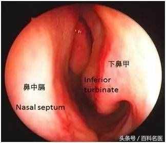 鼻子總是不通氣？別大意！可能是這6種疾病的征兆！