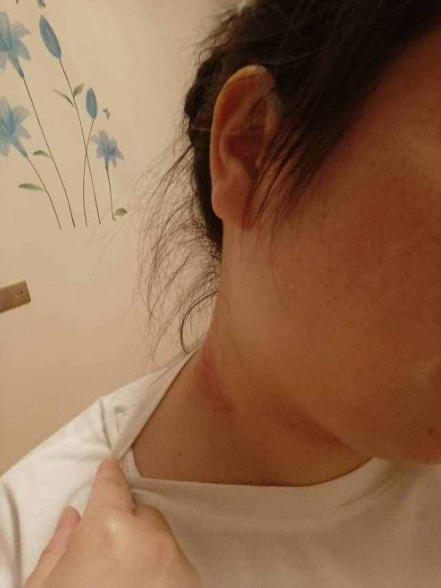 關(guān)于無(wú)花果汁的功效