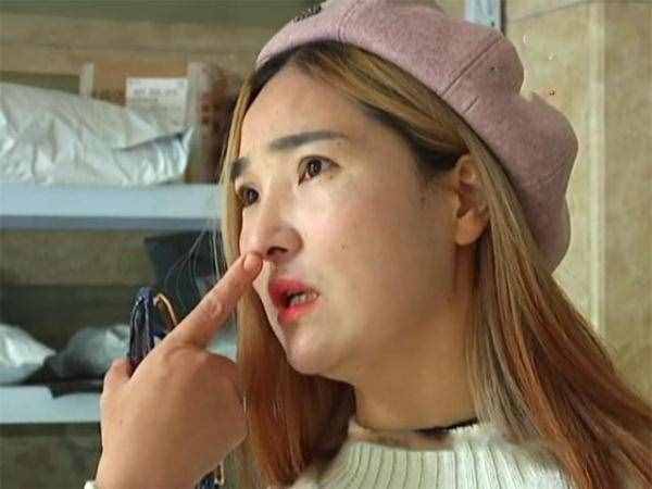 女子花六萬瘦臉，才三個月就恢復(fù)原狀了，女子：一個月兩萬？