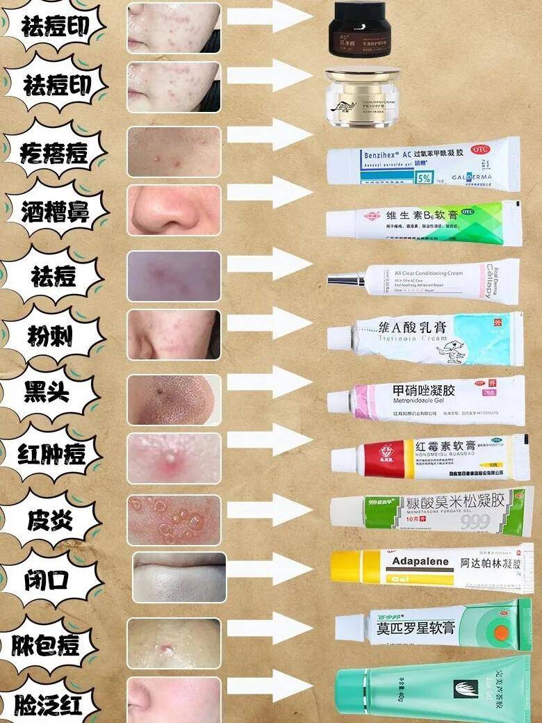 祛痘印護膚干貨，痘肌自備皮膚藥膏合集