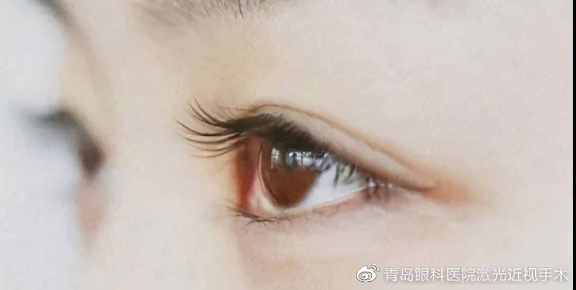 哪些因素會(huì)導(dǎo)致角膜炎？角膜炎如何治療