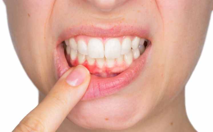 牙齒松動(dòng)別大意，是留還是拔，一篇教你你怎么辦？