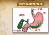 今日更新反流性胃炎（膽汁反流性胃炎）