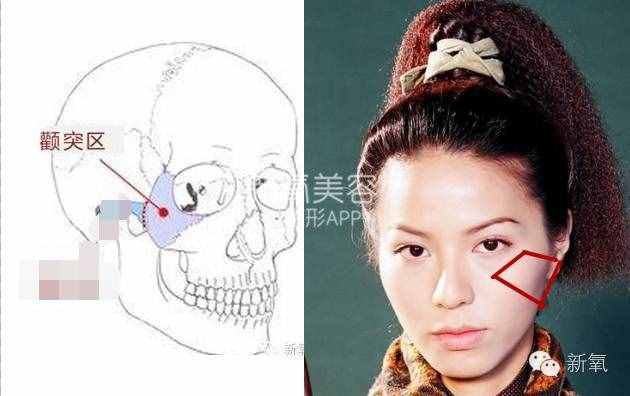 劉濤的高顴骨和劉詩詩的高顴骨是一回事嗎？顴骨高到底怎么辦？