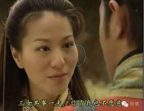 劉濤的高顴骨和劉詩詩的高顴骨是一回事嗎？顴骨高到底怎么辦？