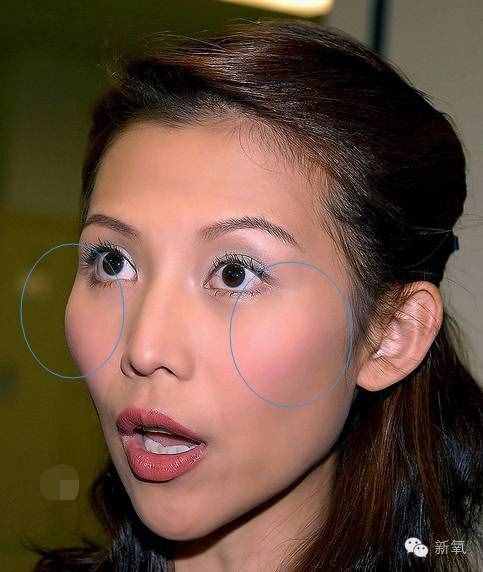 劉濤的高顴骨和劉詩詩的高顴骨是一回事嗎？顴骨高到底怎么辦？