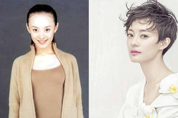 發(fā)際線高怎么辦？