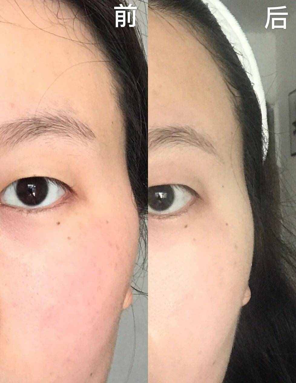 顴骨外擴 太陽穴凹陷，不僅會讓你年齡看起來老10歲