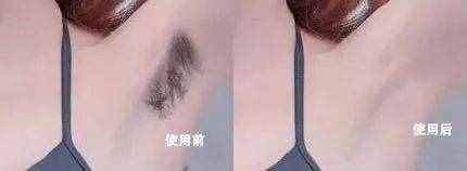 再不脫毛就晚了，4 種靠譜脫毛方式，肌膚光溜一夏