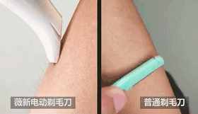再不脫毛就晚了，4 種靠譜脫毛方式，肌膚光溜一夏