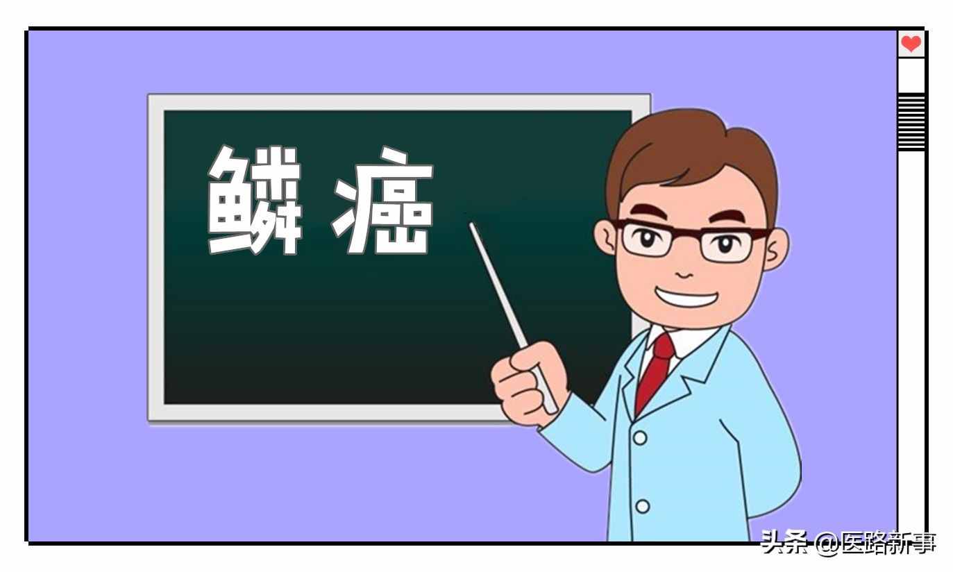 什么是鱗癌？哪些部位容易得呢？日常可以預防嗎？趕快來了解