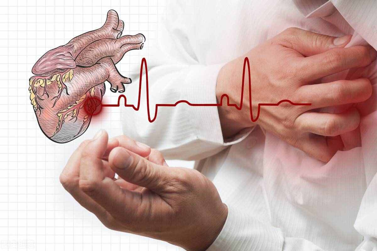 一起了解3個心絞痛的常見癥狀，中醫(yī)是這樣看待心絞痛的