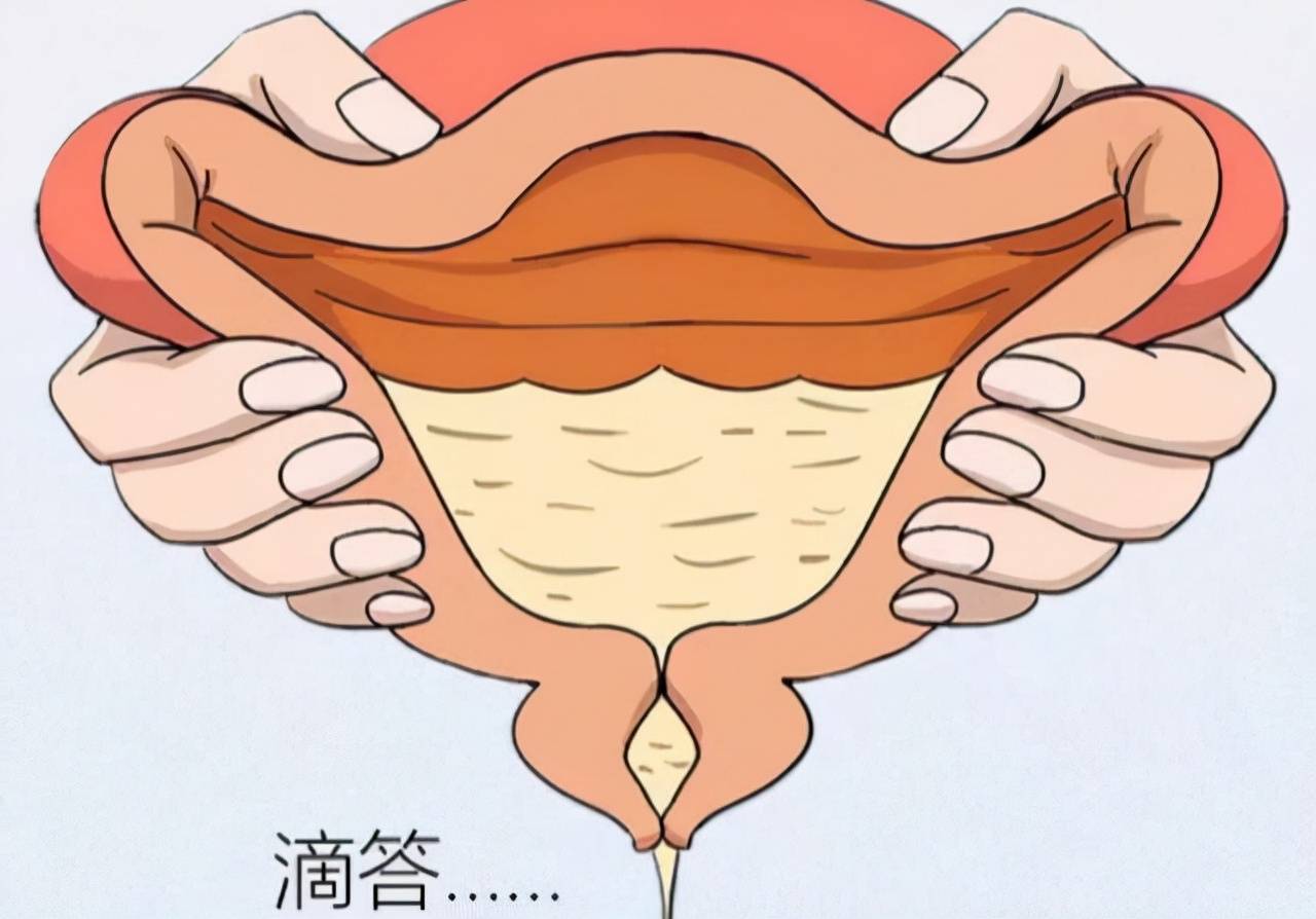 女性尿道口的結(jié)構(gòu)是怎樣的？