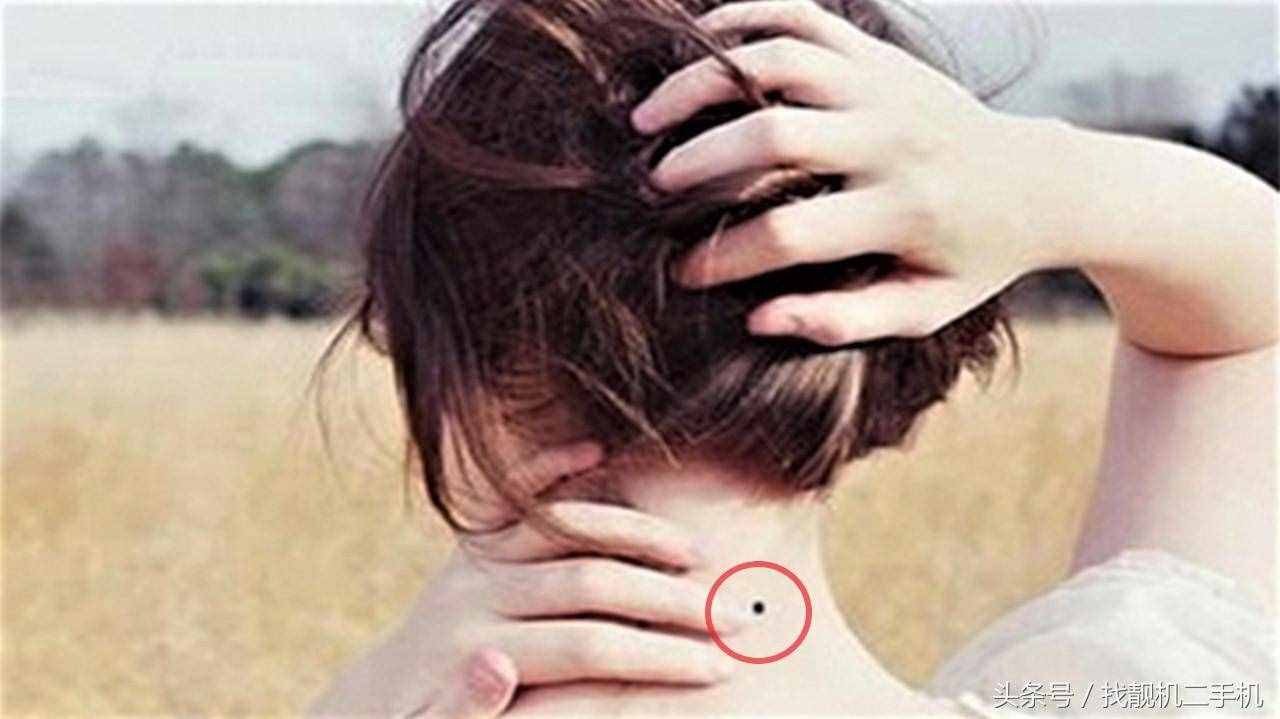 為什么那么多人的脖子后面，總會出現(xiàn)一顆黑痣？