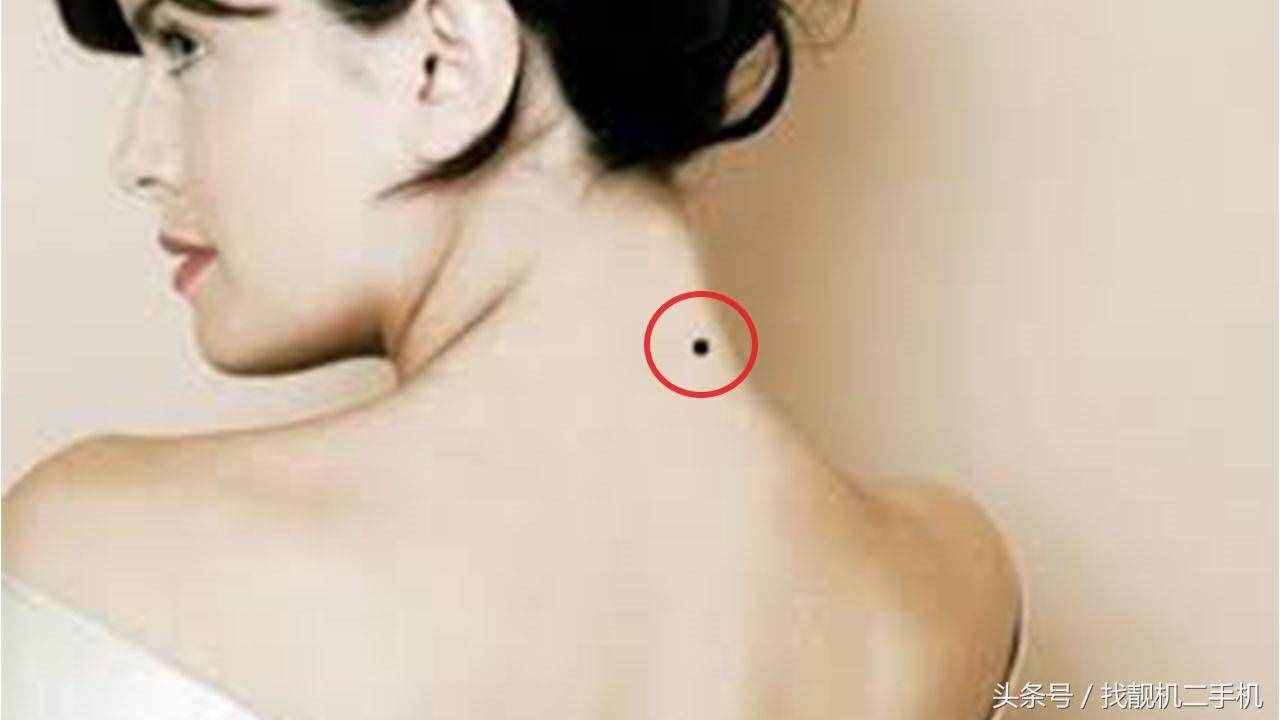 為什么那么多人的脖子后面，總會出現(xiàn)一顆黑痣？