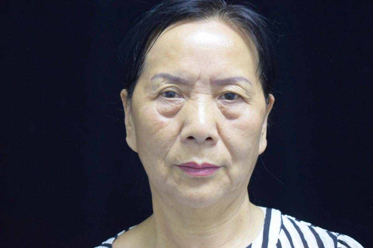 最顯老的不是皺紋，而是眼袋！祛除眼袋的3個妙招，簡單效果好