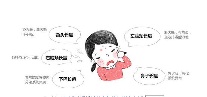 教你如何不長痘？日常護膚多注意這些