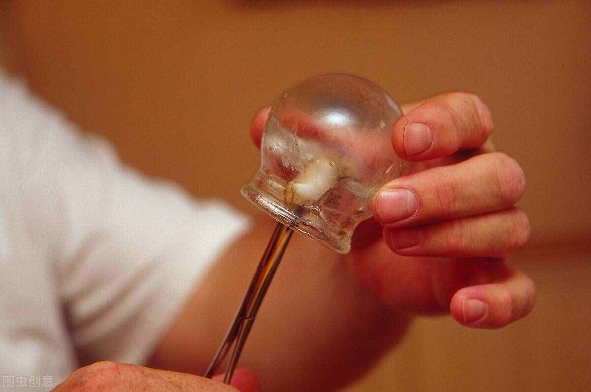 拔罐好處多，可以通絡(luò)止痛、祛除寒濕，但是不是所有人想拔就能拔