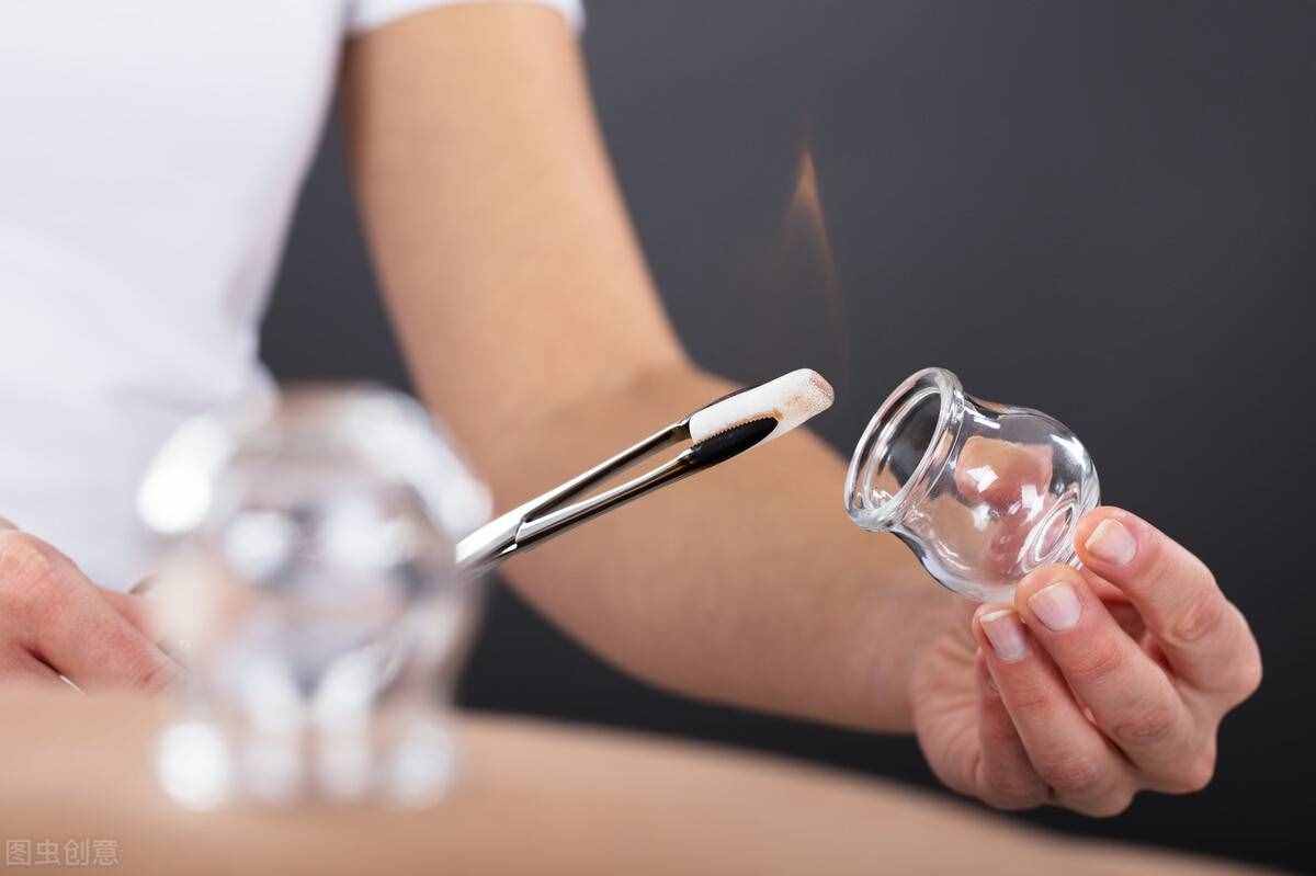 拔罐好處多，可以通絡(luò)止痛、祛除寒濕，但是不是所有人想拔就能拔
