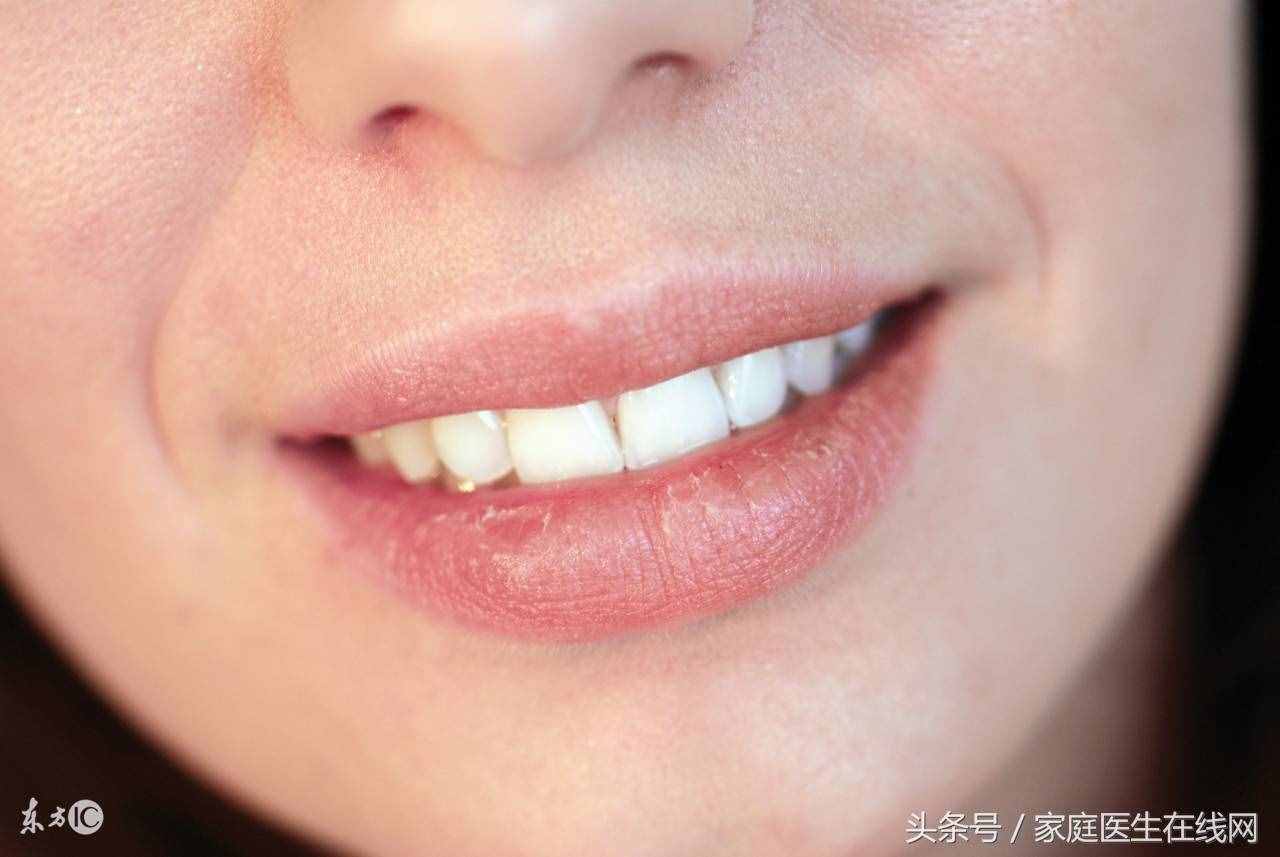 老中醫(yī)公布秘方：多吃點這9種食物，什么火都能降下去