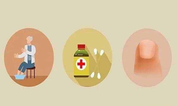 為啥腳趾甲動不動就長到肉里，還疼得受不了？在家怎么解決？