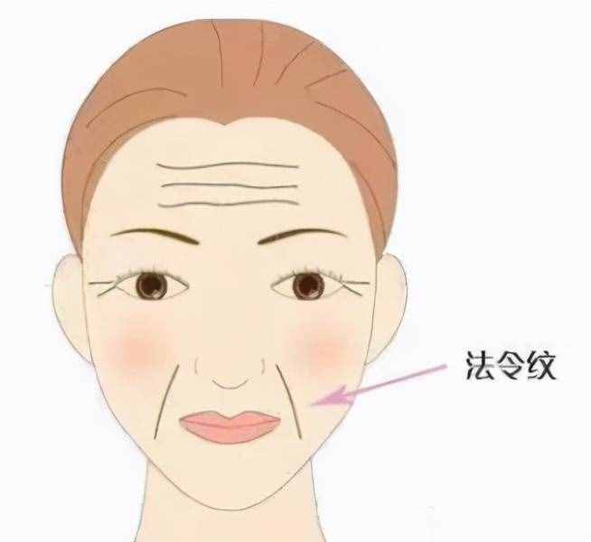 法令紋是如何形成的？怎么改善弱化法令紋？
