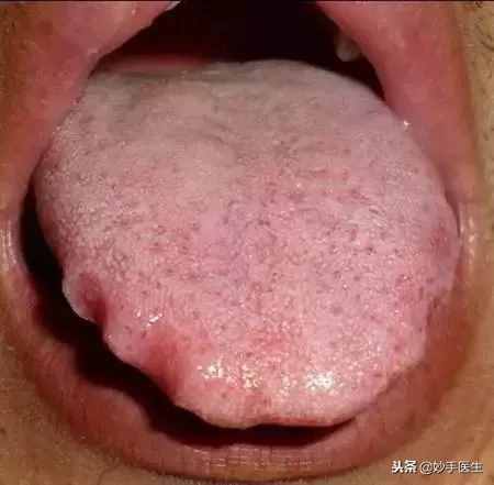 十全大補(bǔ)丸到底有多補(bǔ)！你知道嗎？