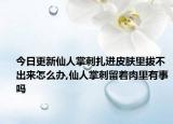 今日更新仙人掌刺扎進(jìn)皮膚里拔不出來怎么辦,仙人掌刺留著肉里有事嗎