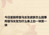 今日更新庫茲馬女友皮膚怎么回事 庫茲馬女友為什么身上白一塊黑一塊