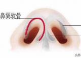 今日更新鼻頭太大怎么變?。ㄓ惺裁春棉k法能讓大鼻頭變?。? /></span></a>
                        <h2><a href=