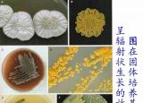 今日更新放線菌閱讀答案（環(huán)境微生物之放線菌）