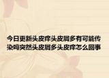 今日更新頭皮癢頭皮屑多有可能傳染嗎突然頭皮屑多頭皮癢怎么回事