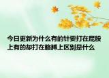 今日更新為什么有的針要打在屁股上有的卻打在胳膊上區(qū)別是什么
