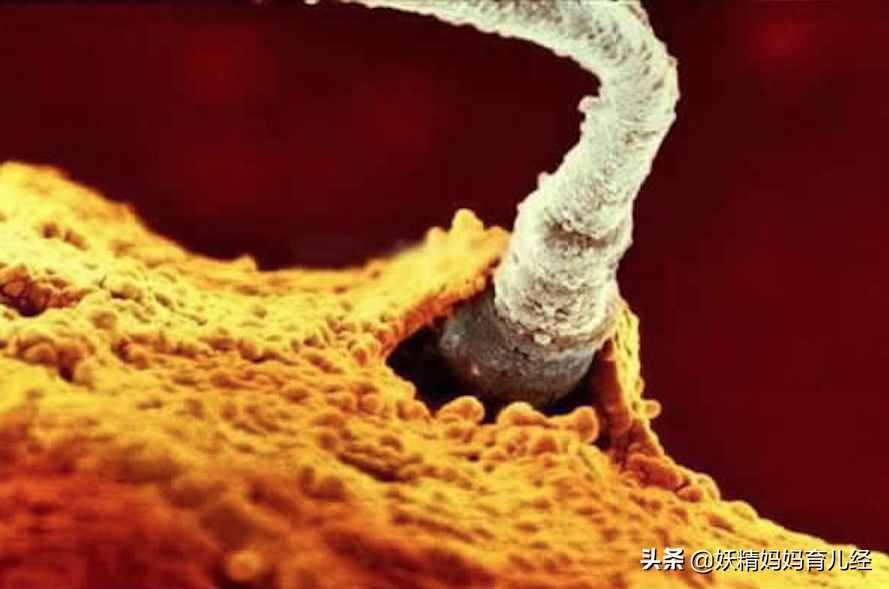 寶寶在媽媽肚子里是什么樣？20張?zhí)喊l(fā)育高清圖，滿足孕媽好奇心