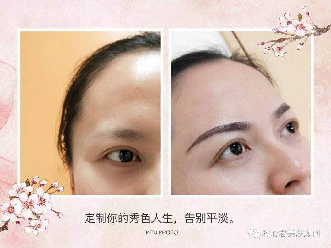 繡眉的方法包括幾種？