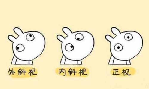 孫灃博士眼科普丨斗雞眼如何矯正