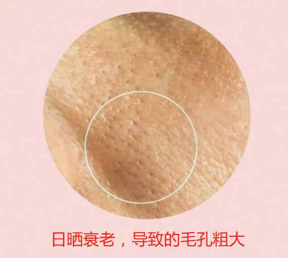 女人毛孔粗大怎么辦？掌握這些方法，原來(lái)收縮毛孔這么簡(jiǎn)單