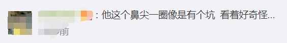 韓國男星曬整容前后對比，差距太大很驚人，被指最新照鼻尖像有坑