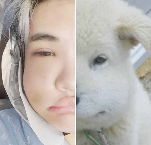 韓國男星曬整容前后對比，差距太大很驚人，被指最新照鼻尖像有坑