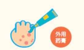 叫癬不是“癬”，細(xì)數(shù)牛皮癬的那些事