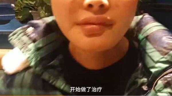 24歲女孩花4萬元整容下頜手術變歪嘴，哭訴我還沒有結(jié)婚呢