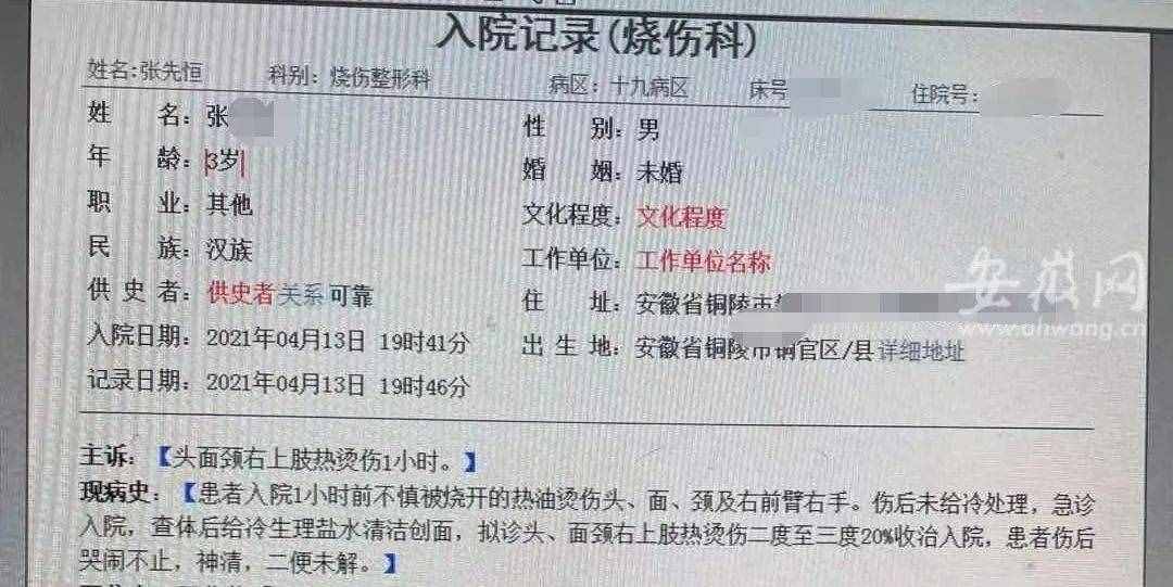 太揪心！一鍋熱油從2歲寶寶頭上澆下，事發(fā)銅陵