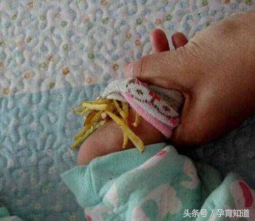 分享一個專治感冒流鼻涕的小偏方，成本不到1元哦，馬上收藏轉(zhuǎn)發(fā)