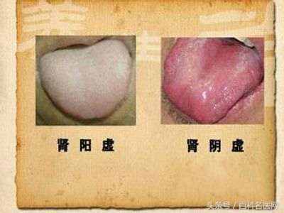 腎虛催人老？分清陰虛陽虛是關(guān)鍵！3種食物壯陽補(bǔ)腎！