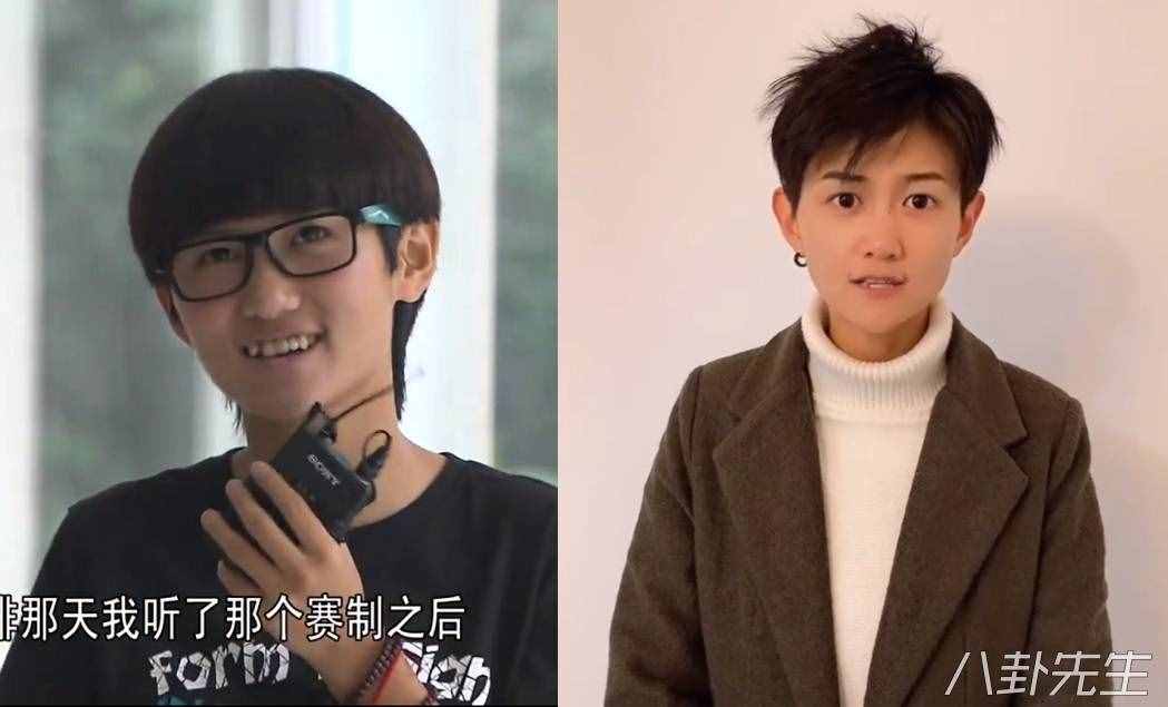 這些超女出道后都整容了？今昔對(duì)比明顯，背后是她們想紅的無(wú)奈