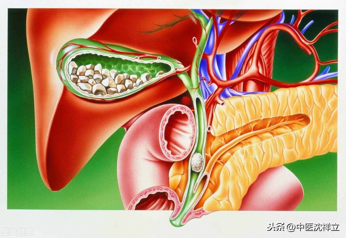 從患者那得來一張治膽囊結(jié)石秘方，初看不以為意，細(xì)思只有佩服