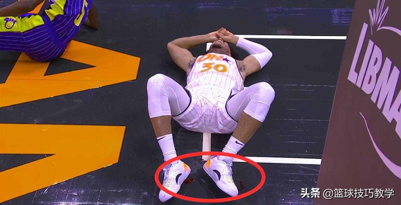 剛打1分鐘就遭遇開放性骨折！隊(duì)友被嚇得后退，他的NBA之旅難了