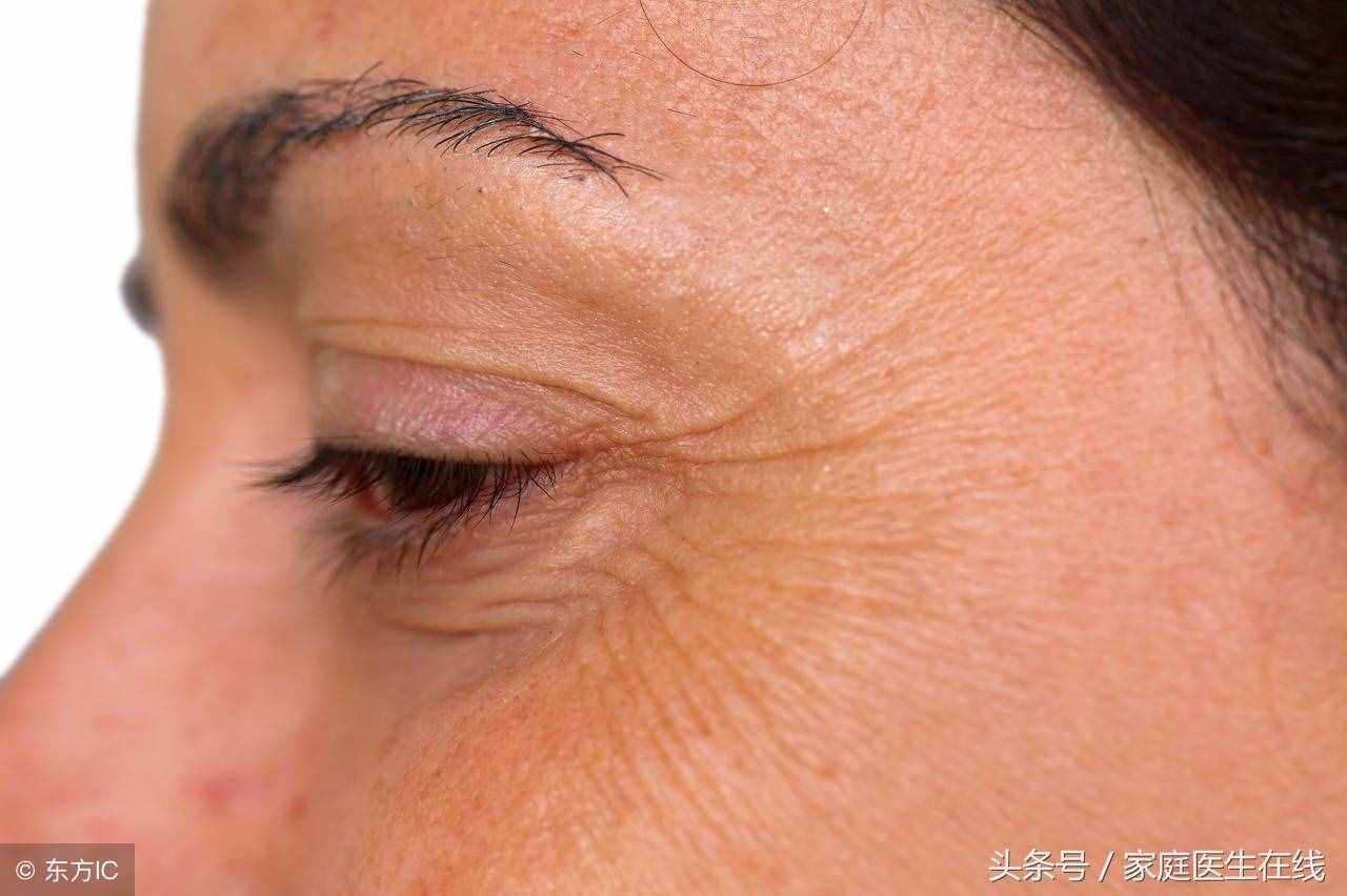 皺紋悄悄爬上眼角？5個妙招撫平皺紋，年輕十歲！