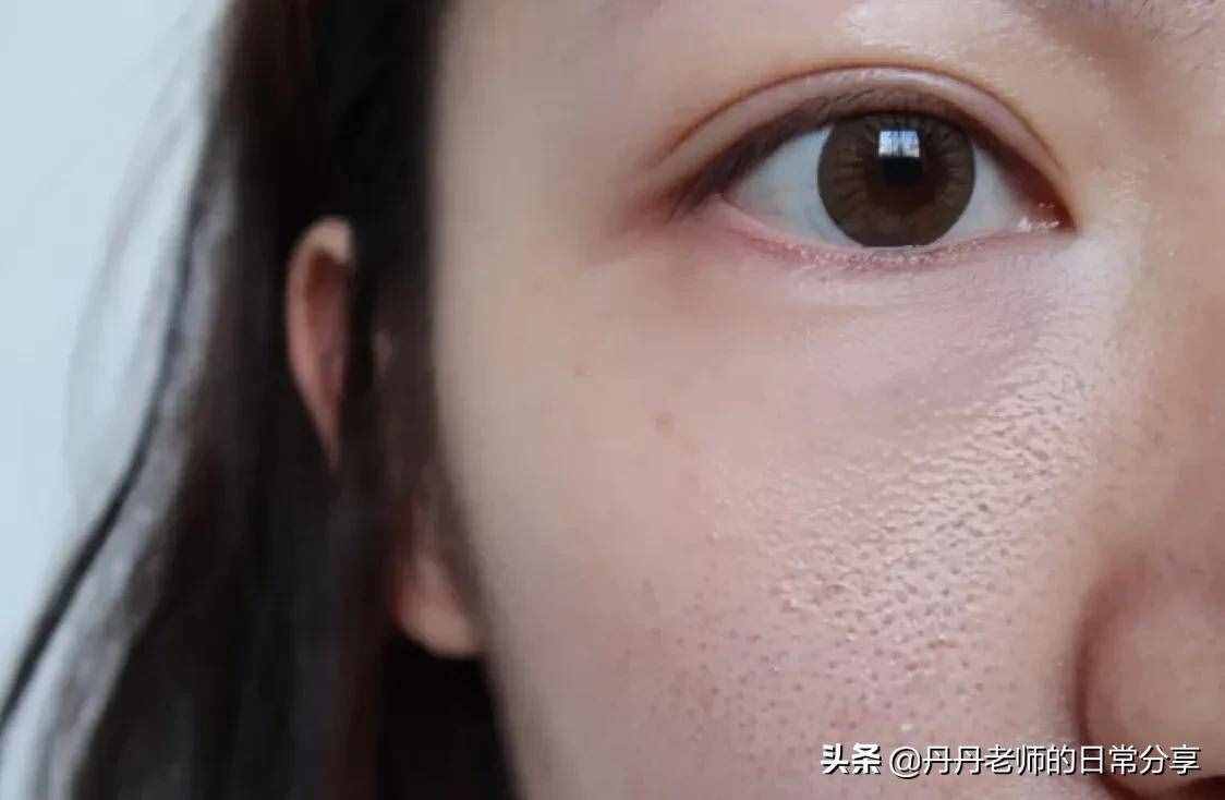 面部毛孔粗大怎么辦，怎么收縮毛孔？